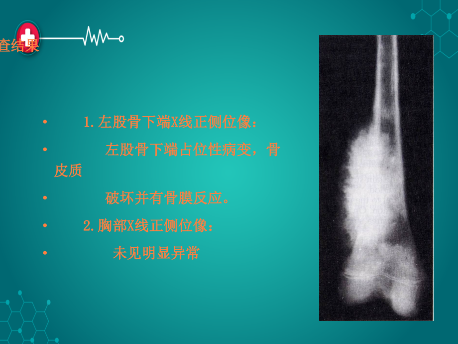 第六章 肿瘤ppt课件_第3页