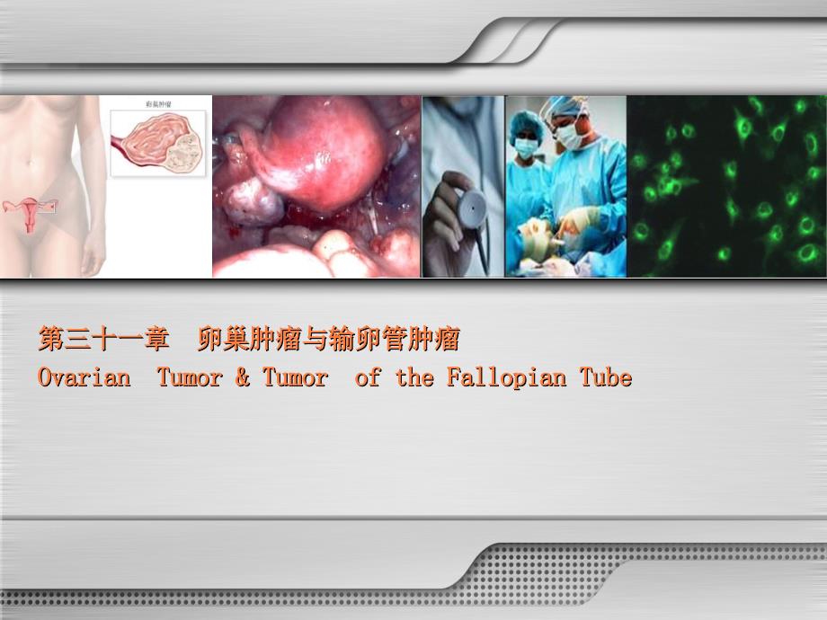 第八版 卵巢肿瘤与输卵管肿瘤ppt课件_第3页