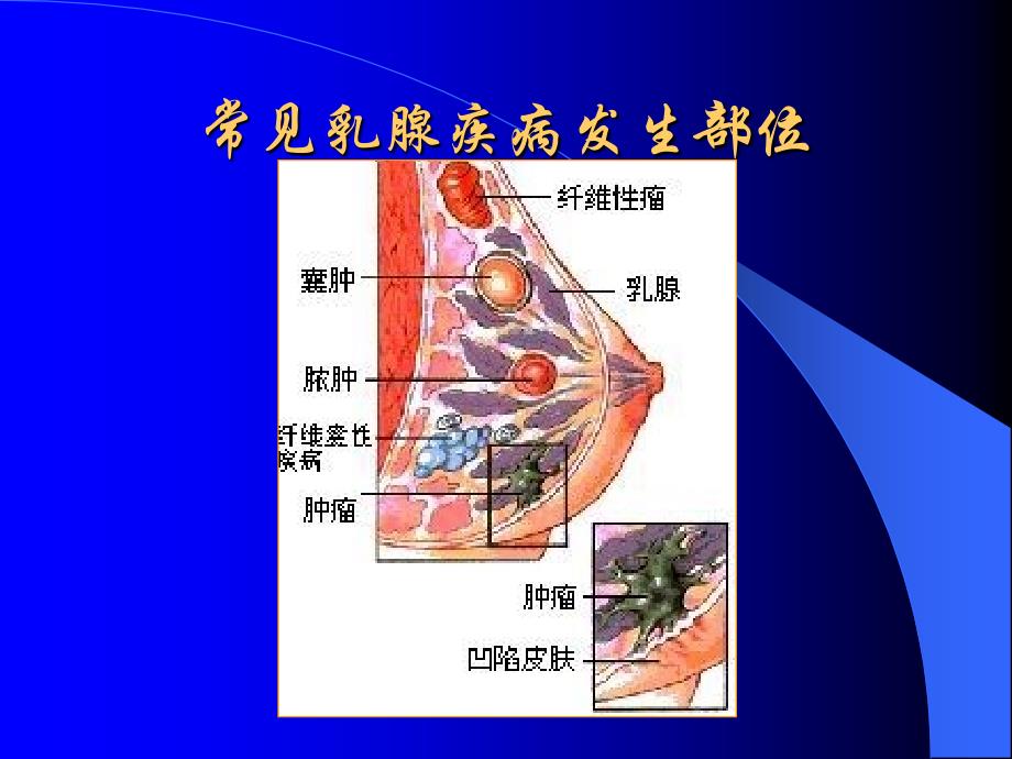 产前产后的乳房保健课件ppt课件_第3页