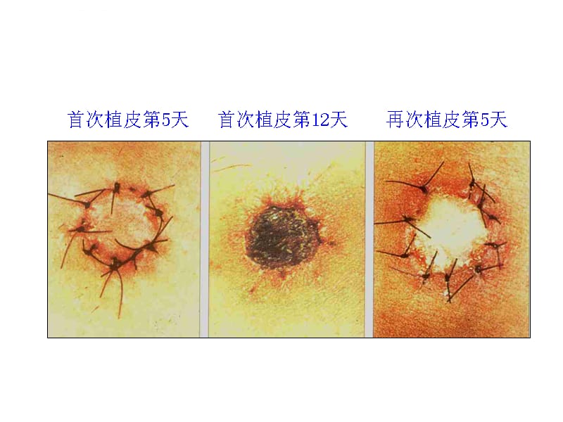 免疫学 第6章 主要组织相容性复合体_第4页