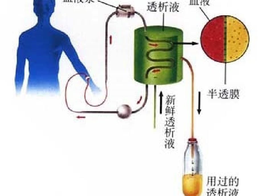 连续性肾脏替代疗法(CRRT)(新)ppt课件_第5页