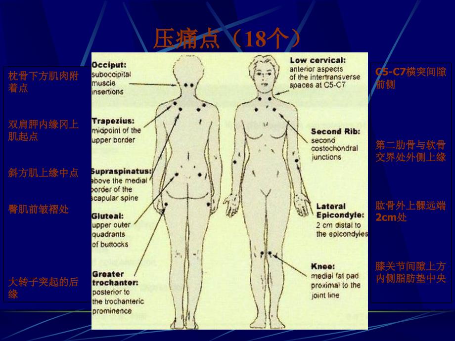 纤维肌痛综合征ppt课件_第3页