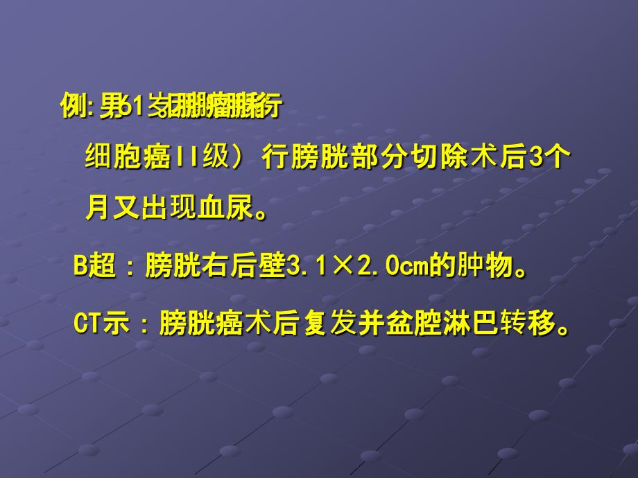 膀胱小细胞癌的诊治及预后ppt课件_第3页