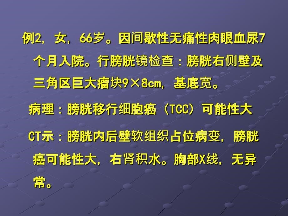 膀胱小细胞癌的诊治及预后ppt课件_第5页