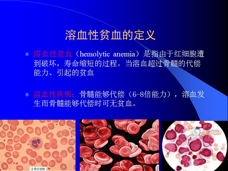 溶血性贫血总结ppt课件_第4页