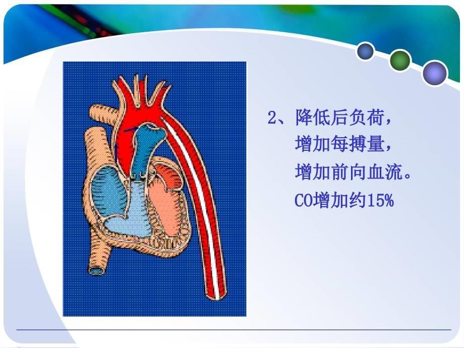 主动脉球囊反搏iabp的应用和护理教学幻灯片_第5页