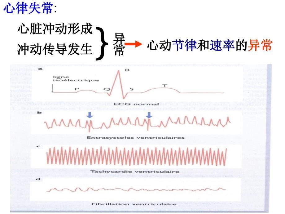 第19章 抗心律失常药课件_第5页