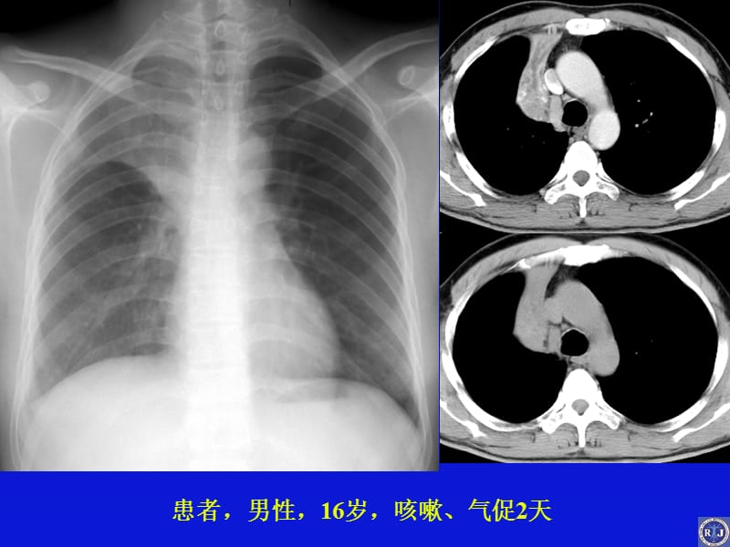 {交通运输管理}某市交通大学医学院某某某年住院医师考试—读片_第3页