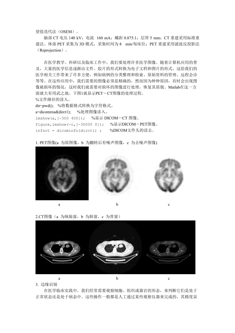 PET-CT图像感兴趣区勾画及三维重建.doc_第2页