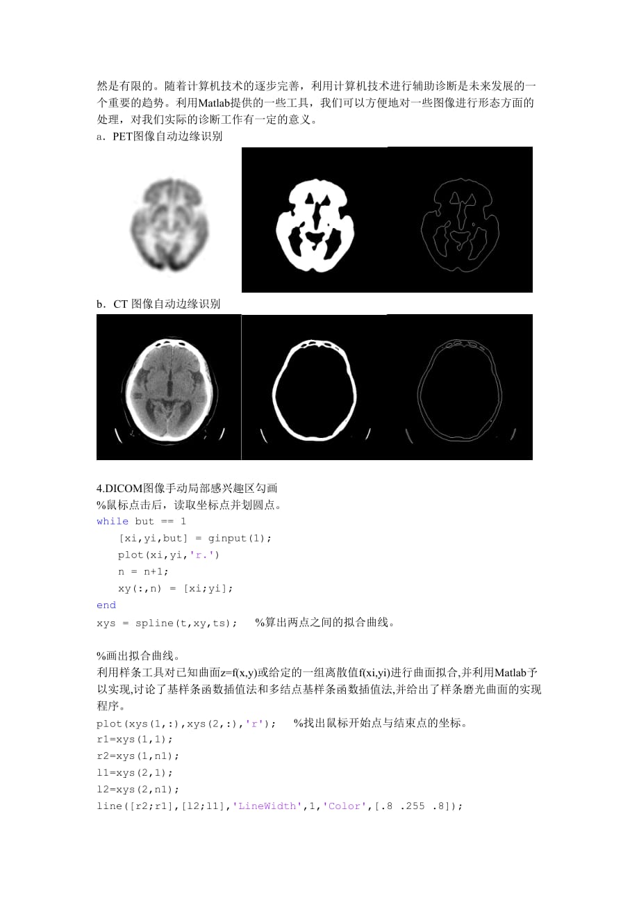 PET-CT图像感兴趣区勾画及三维重建.doc_第3页