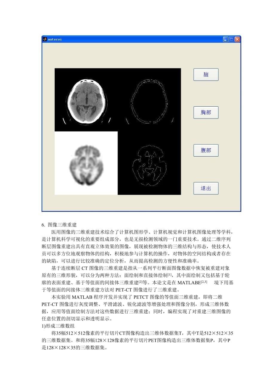 PET-CT图像感兴趣区勾画及三维重建.doc_第5页