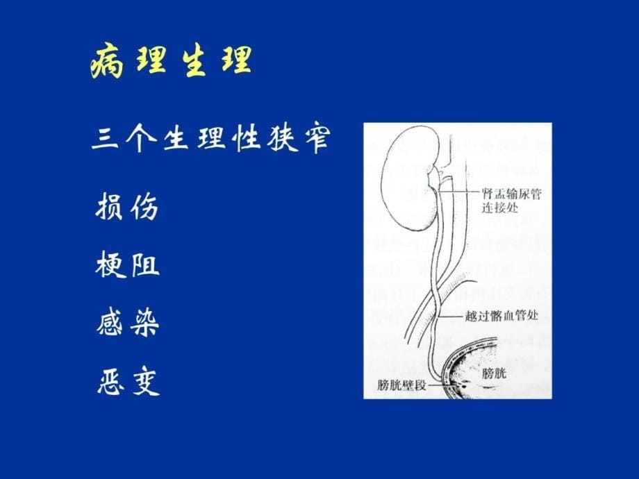 泌尿系结石说课讲解_第5页