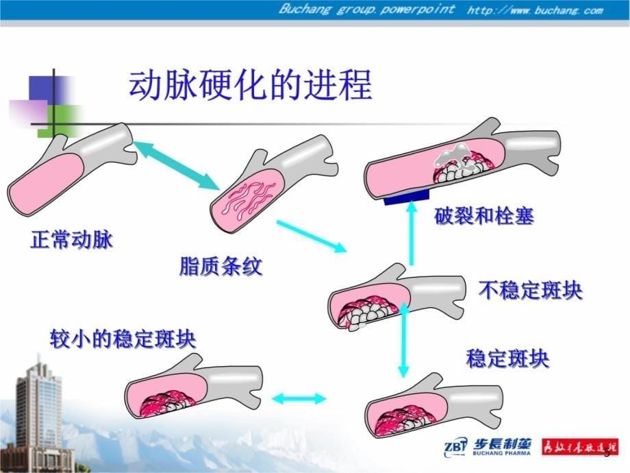 -脑心通-03高端会学术会说课讲解_第5页