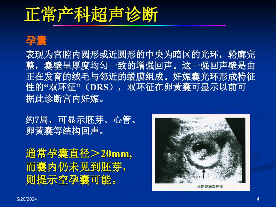 妇产科超声检查PPT(完整版)_第4页