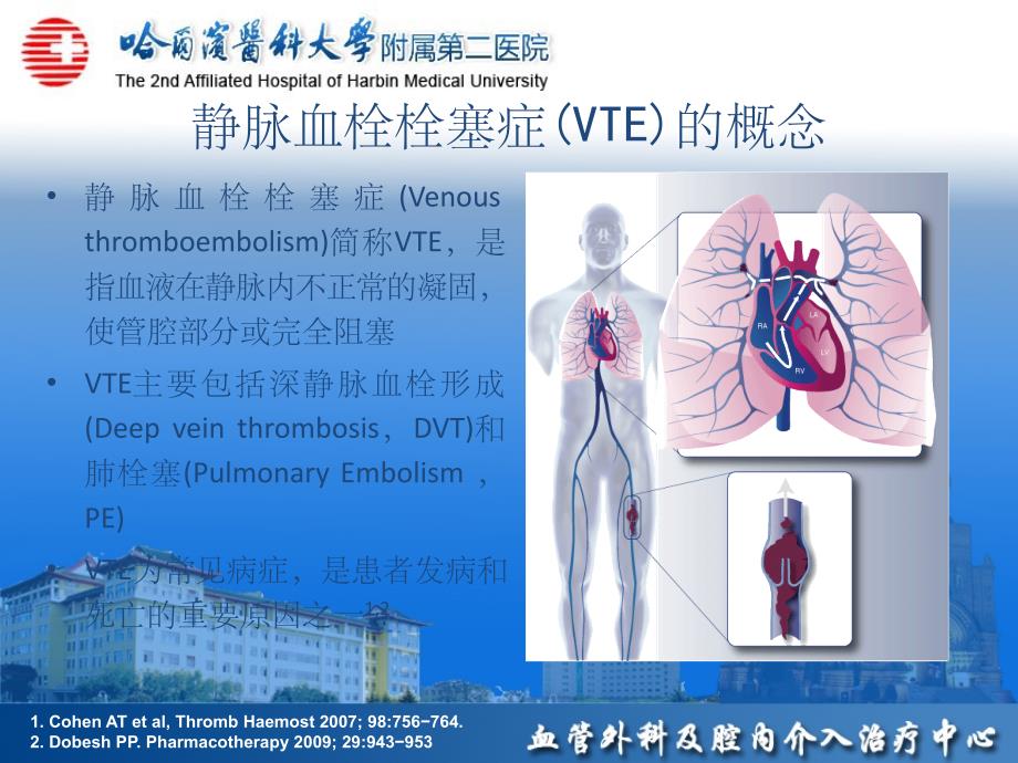 静脉血栓栓塞(VTE)诊断、治疗和预防ppt课件_第4页