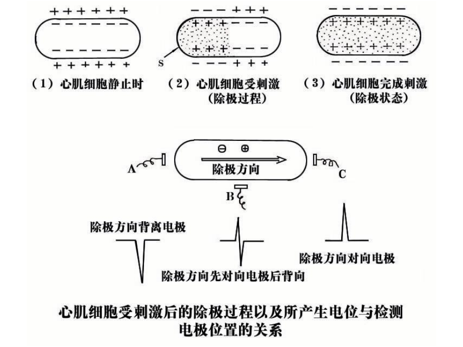 心电图诊断图谱教学文案_第4页