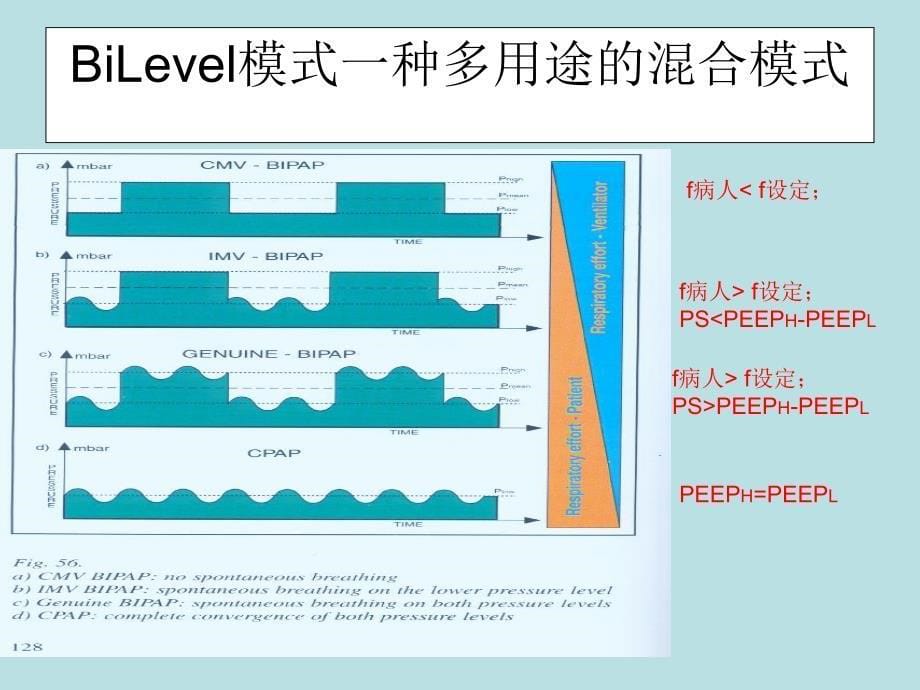 BiLevel双水平通气模式简介备课讲稿_第5页