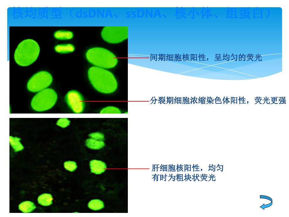 ANA荧光模型判读教案资料_第3页