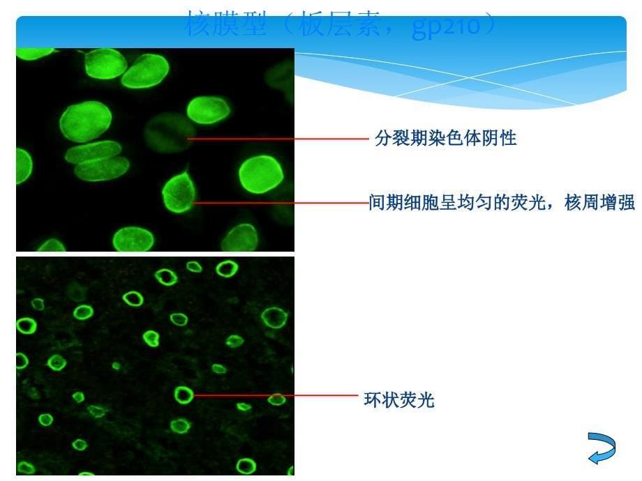 ANA荧光模型判读教案资料_第5页