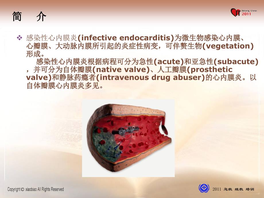 感染性心内膜炎诊治现状资料讲解_第2页