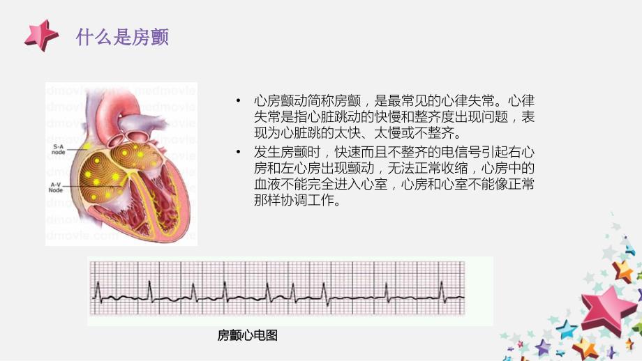 正确认识房颤_第4页