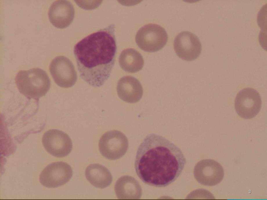 异常血细胞形态PPT课件_第3页