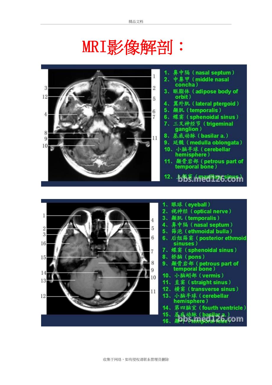 MRI影像解剖复习进程_第2页