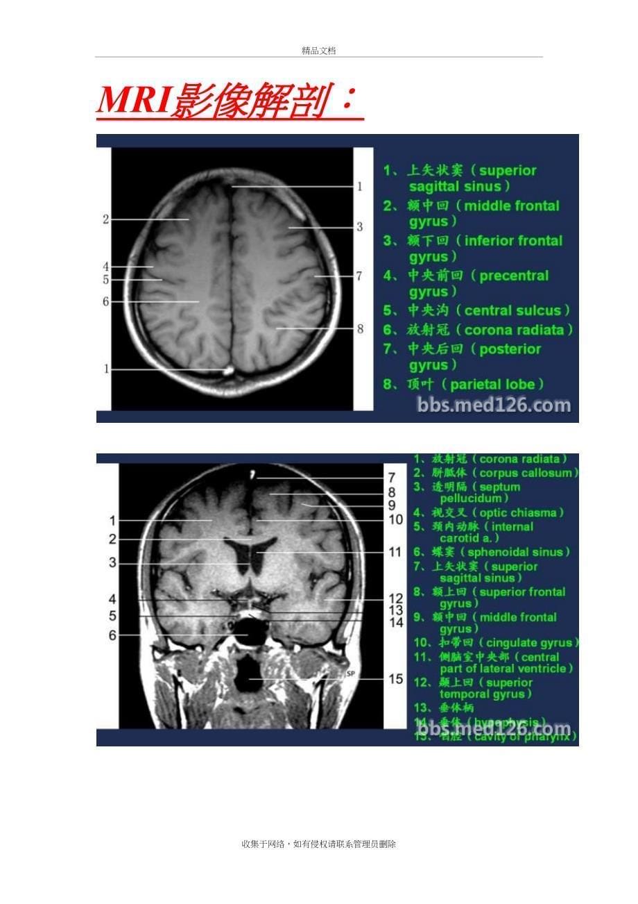 MRI影像解剖复习进程_第5页