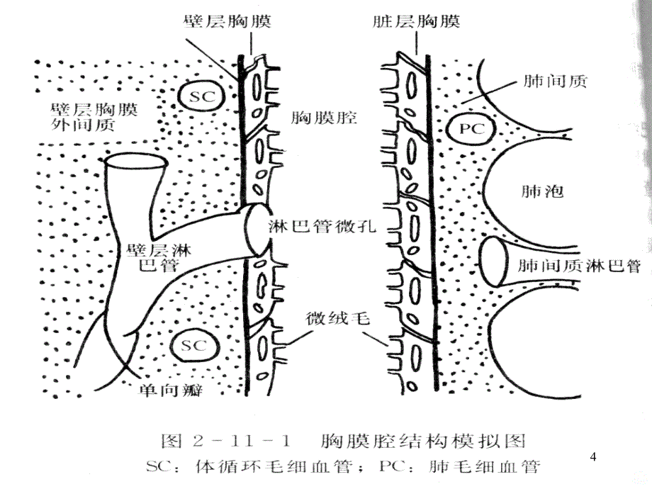 胸水诊疗规范PPT课件_第4页