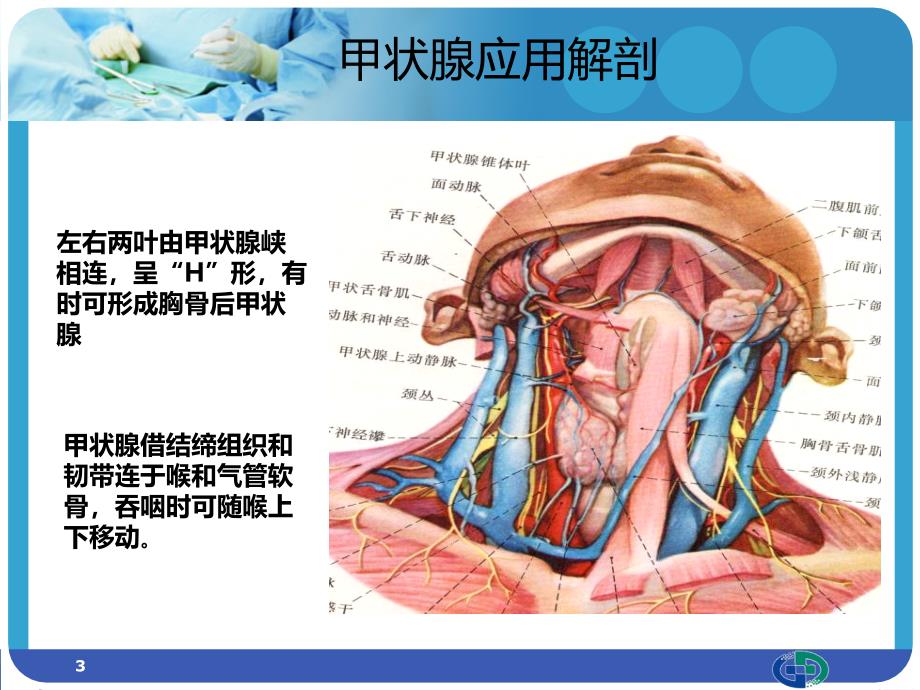 甲状腺肿物切除术配合PPT课件_第3页