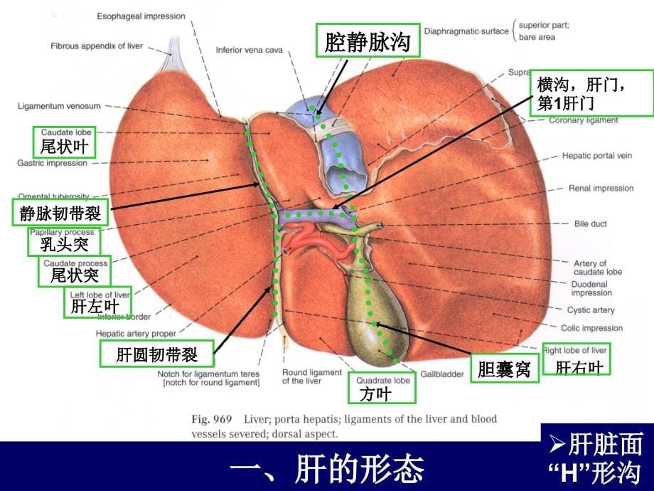 肝和胆囊的断层解剖-腹部断层解剖学人体断层解剖学ppt课件_第5页