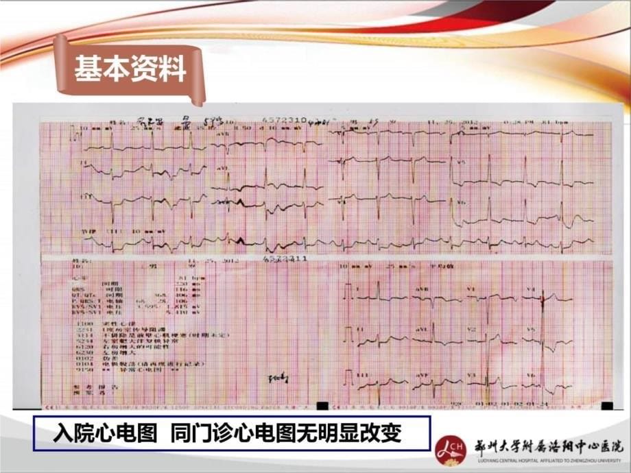 如履薄冰陷阱无处不在病例分享演示教学_第5页