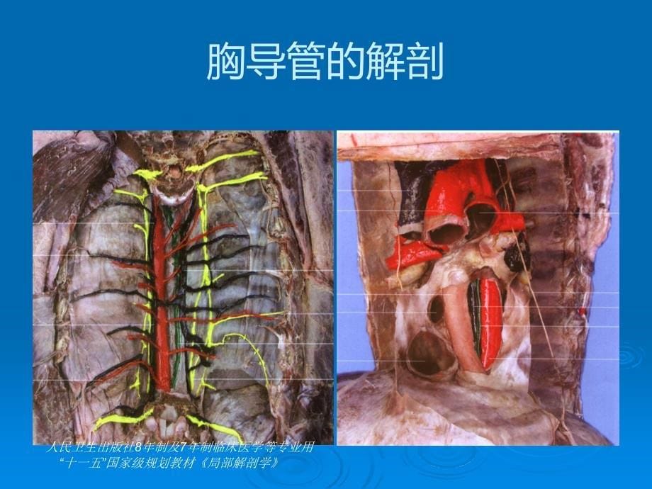 胸导管的解剖PPT课件_第5页