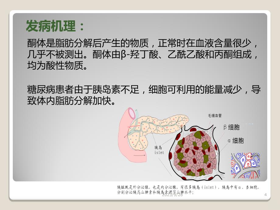 糖尿病酮症酸中毒最新PPT课件_第4页