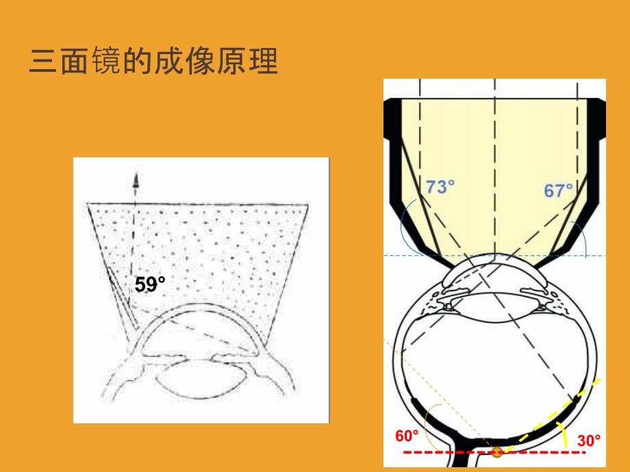 三面镜检查word版本_第4页