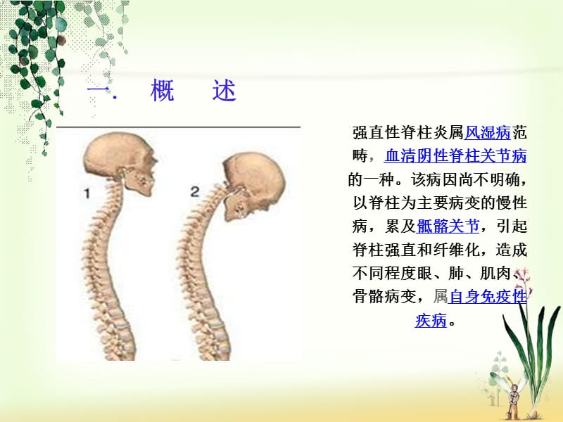 强直性脊柱炎的观察与护理PPT课件_第4页