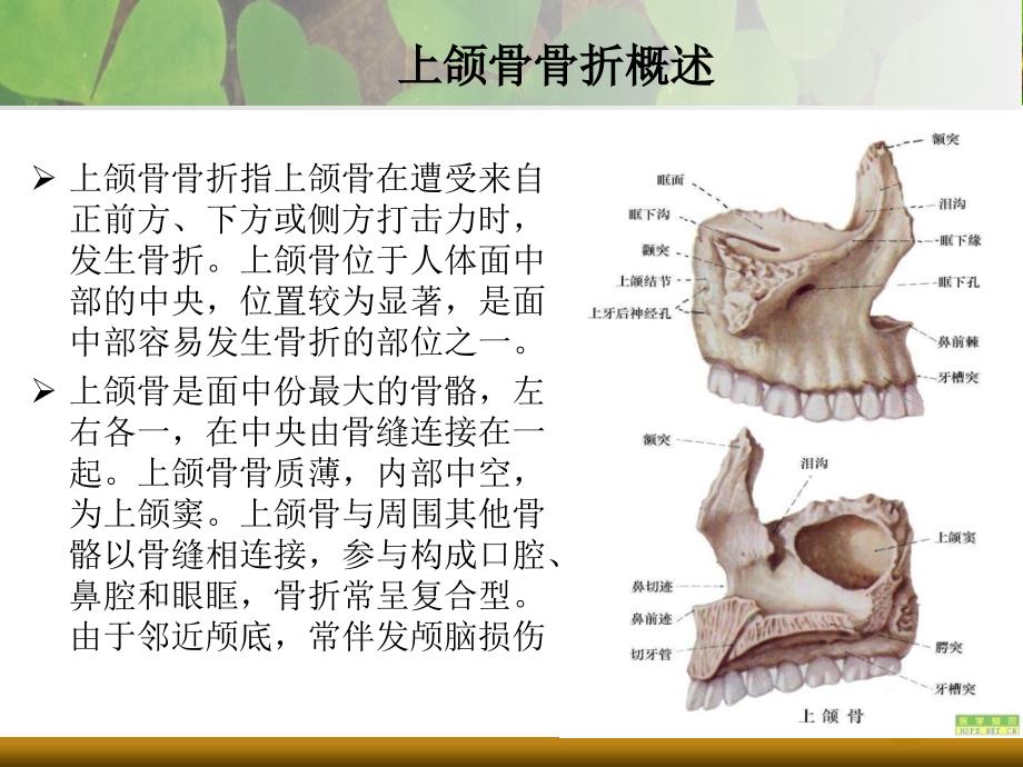 上下颌骨骨折说课材料_第3页