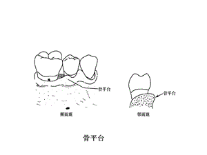 牙 周 病 学 第四版