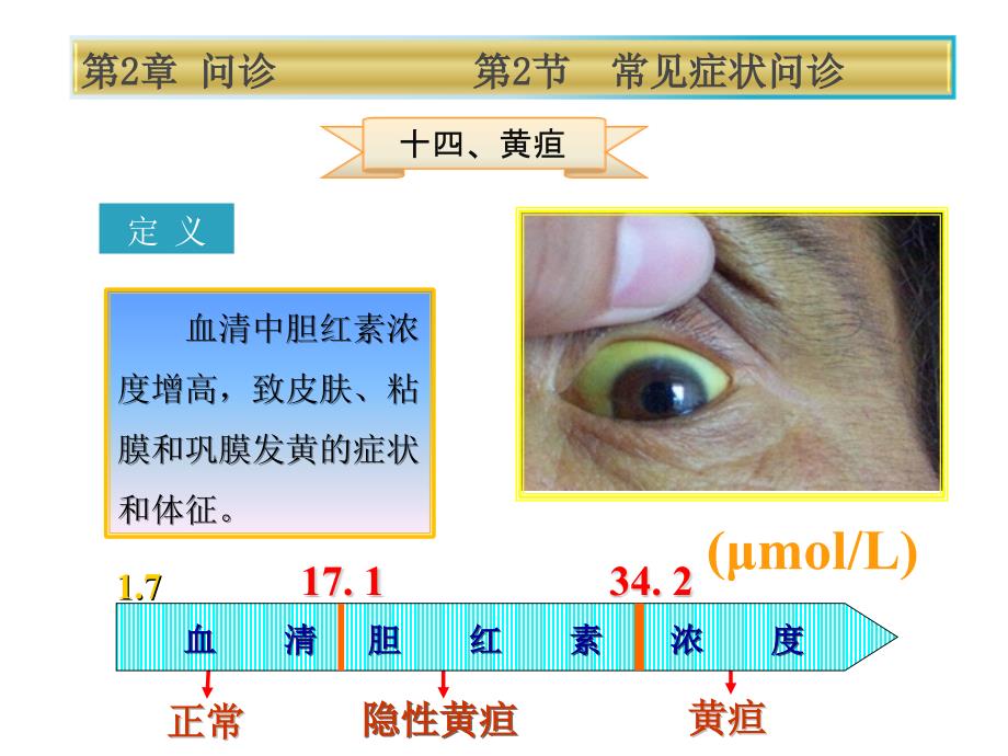 健康评估第2章第2节黄疸[20页]_第2页
