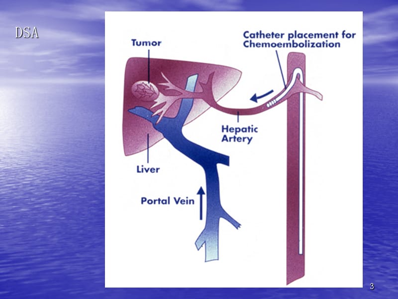 肝脏影像检查方法及正常影像解剖PPT课件_第3页