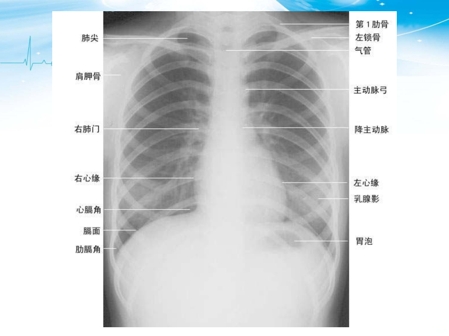 胸部X线解剖PPT课件_第2页