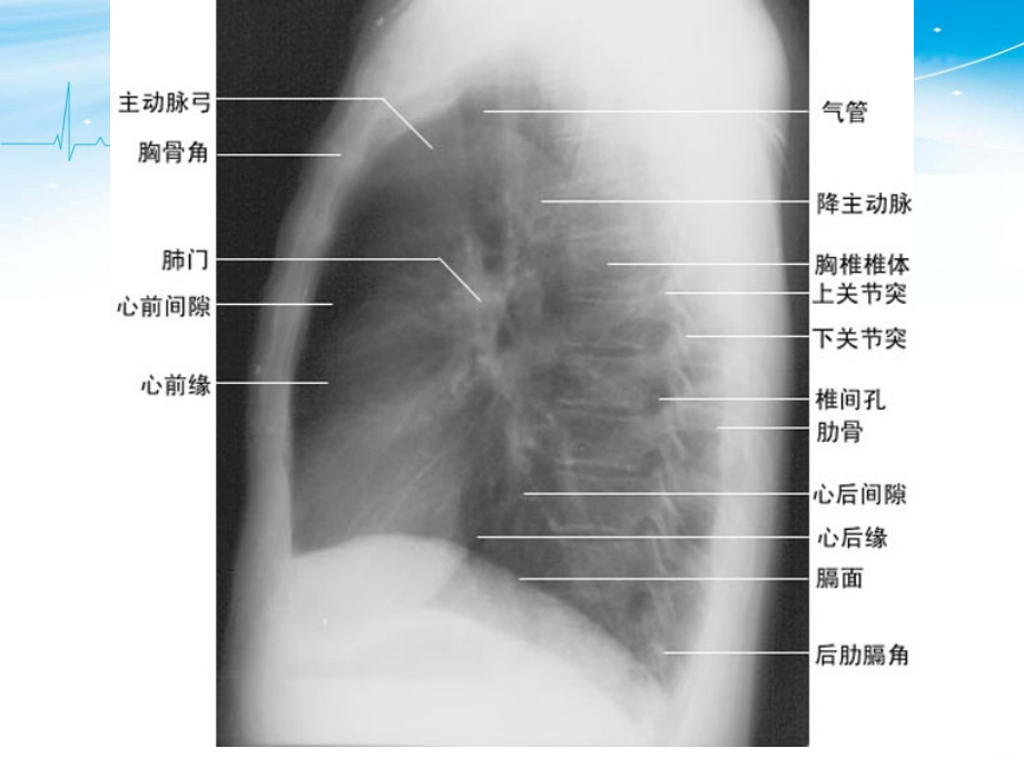 胸部X线解剖PPT课件_第3页