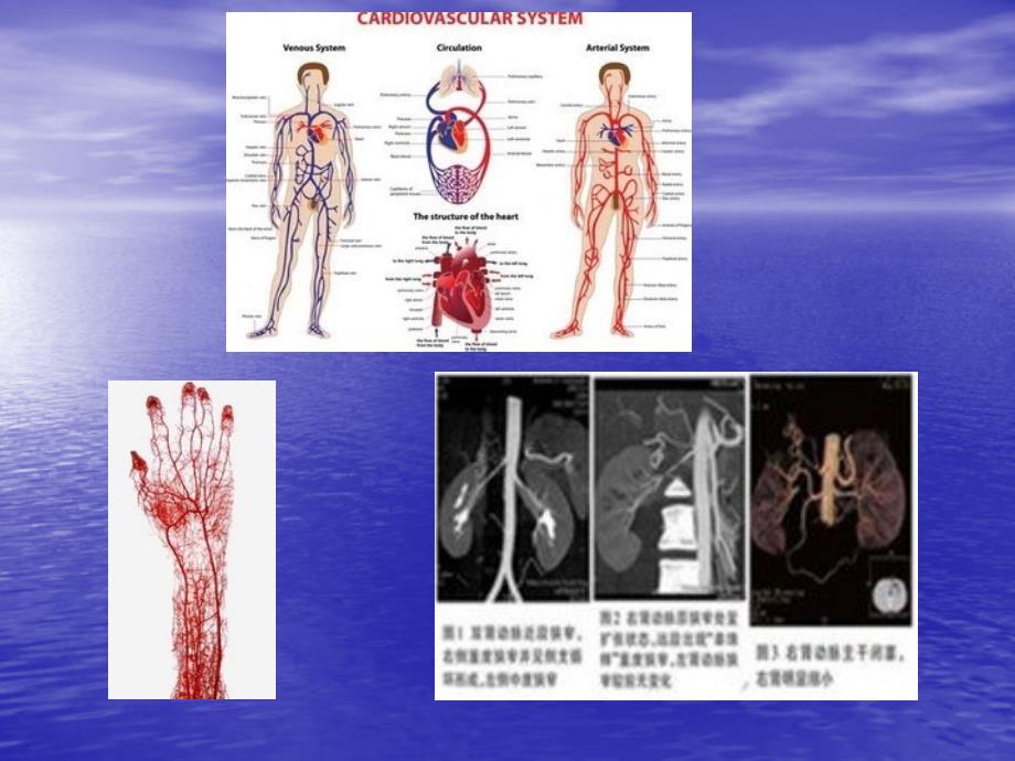 血管病变及防治ppt课件_第3页