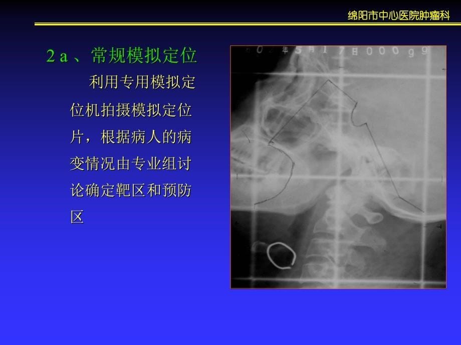 {生物科技管理}放射治疗计划设计的临床要求和生物学因素_第5页