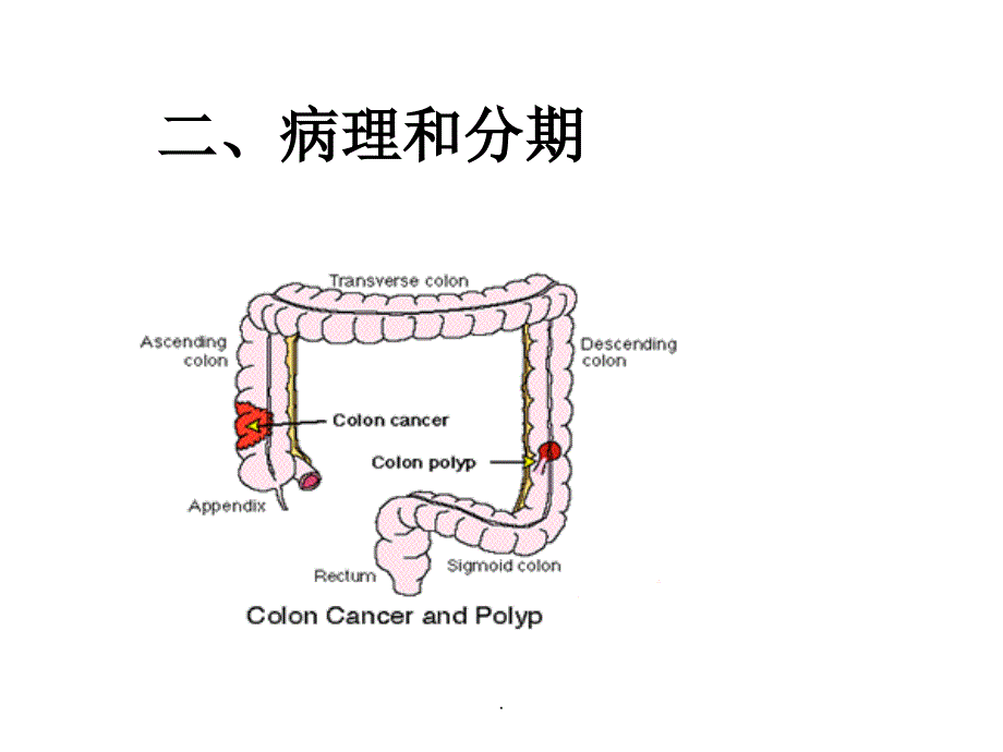 结肠癌与直肠癌ppt课件_第4页