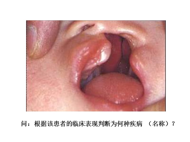 问：根据该患者的临床表现判断为何种疾病 （名称）？_第1页