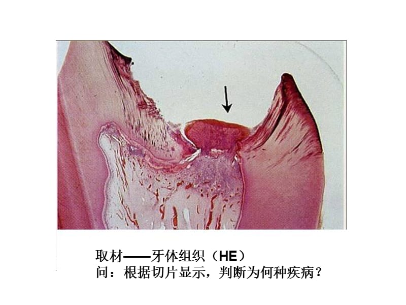 问：根据该患者的临床表现判断为何种疾病 （名称）？_第2页