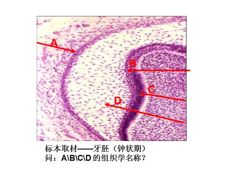 问：根据该患者的临床表现判断为何种疾病 （名称）？_第4页