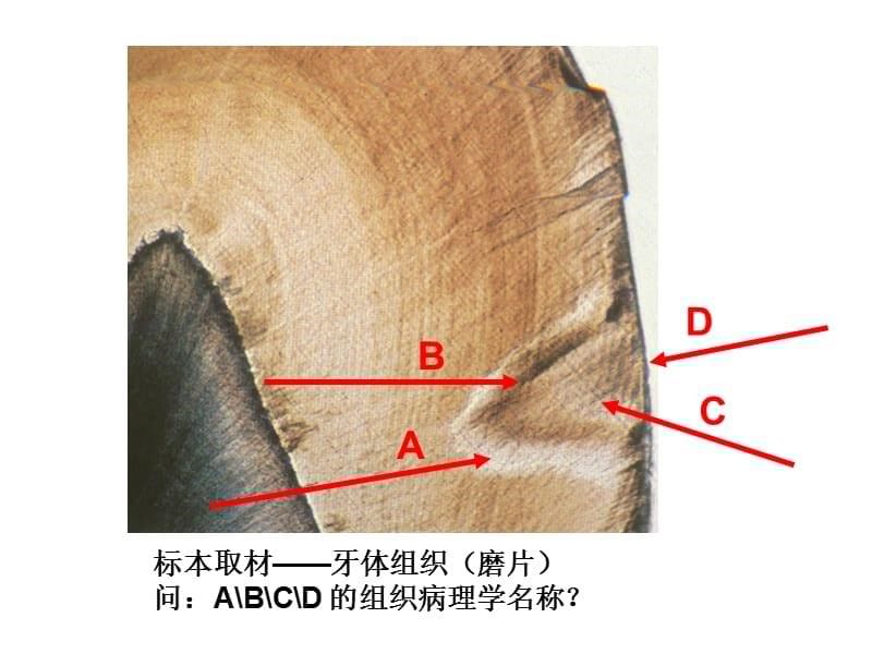 问：根据该患者的临床表现判断为何种疾病 （名称）？_第5页