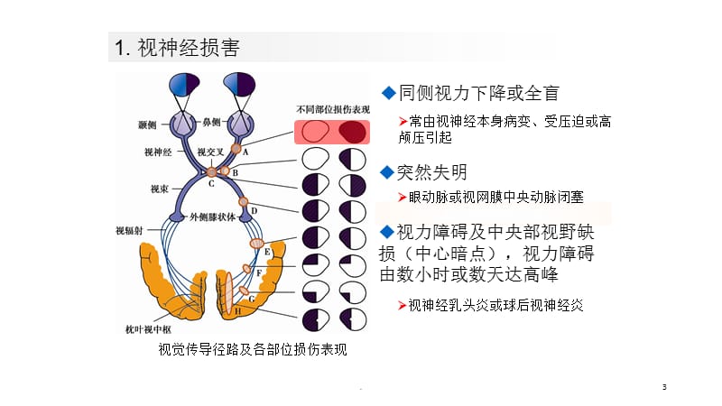 西综考试版PPT课件_第3页